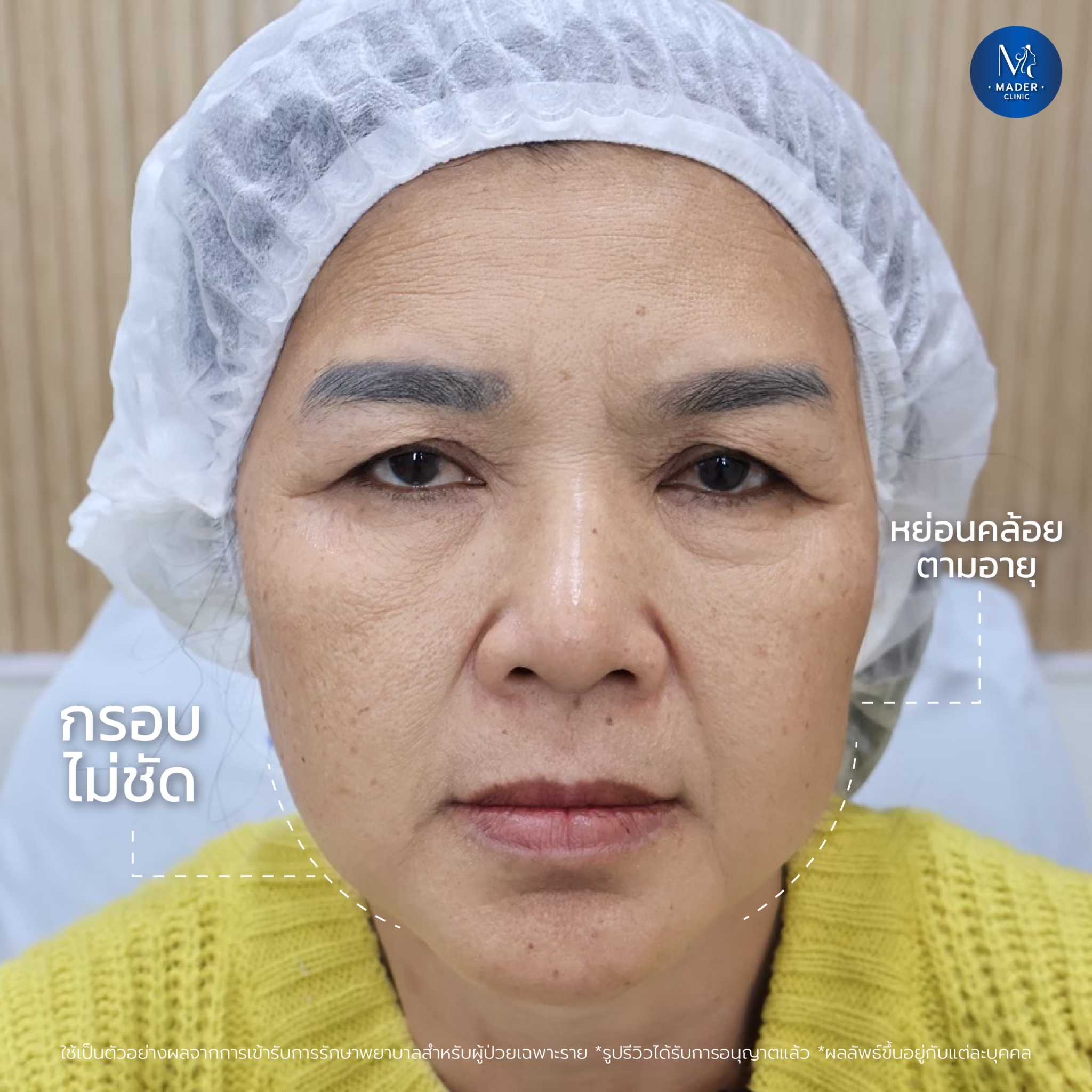 รีวิว MADER Clinic