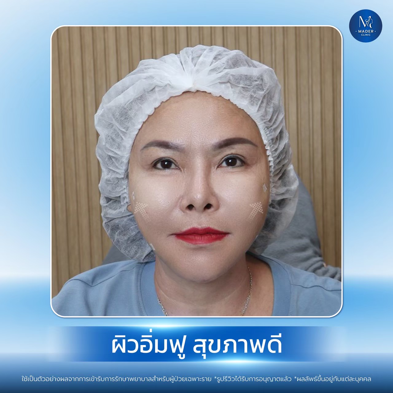 รีวิว MADER Clinic