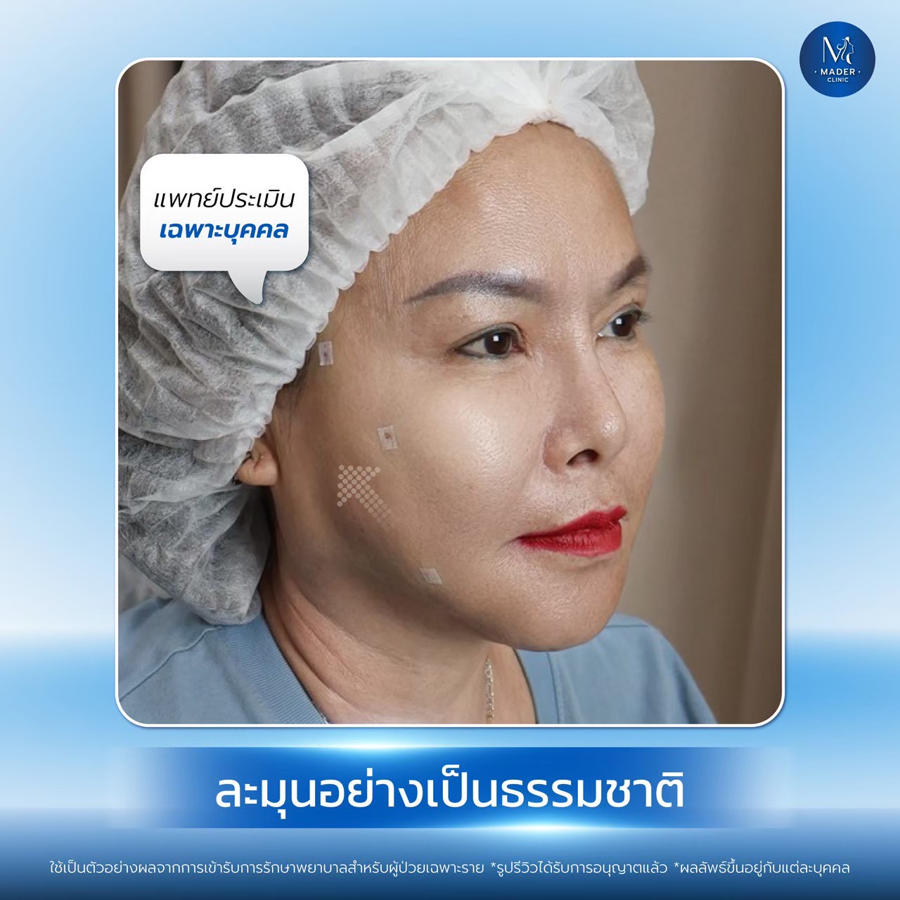 รีวิว MADER Clinic