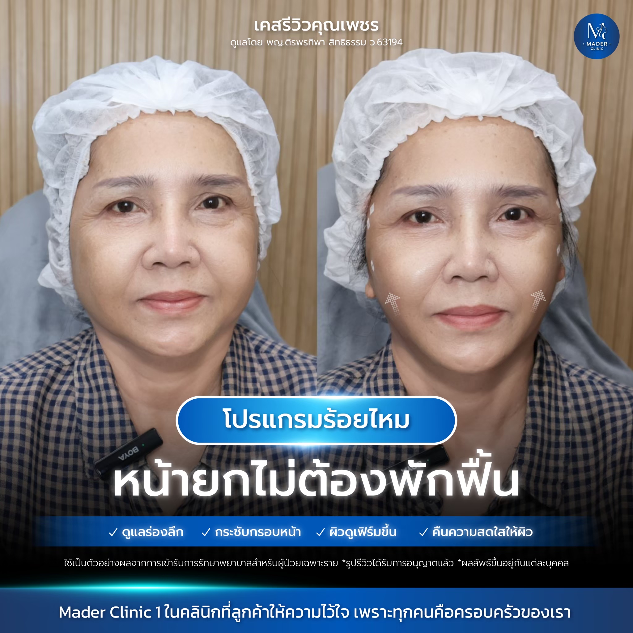 รีวิว MADER Clinic
