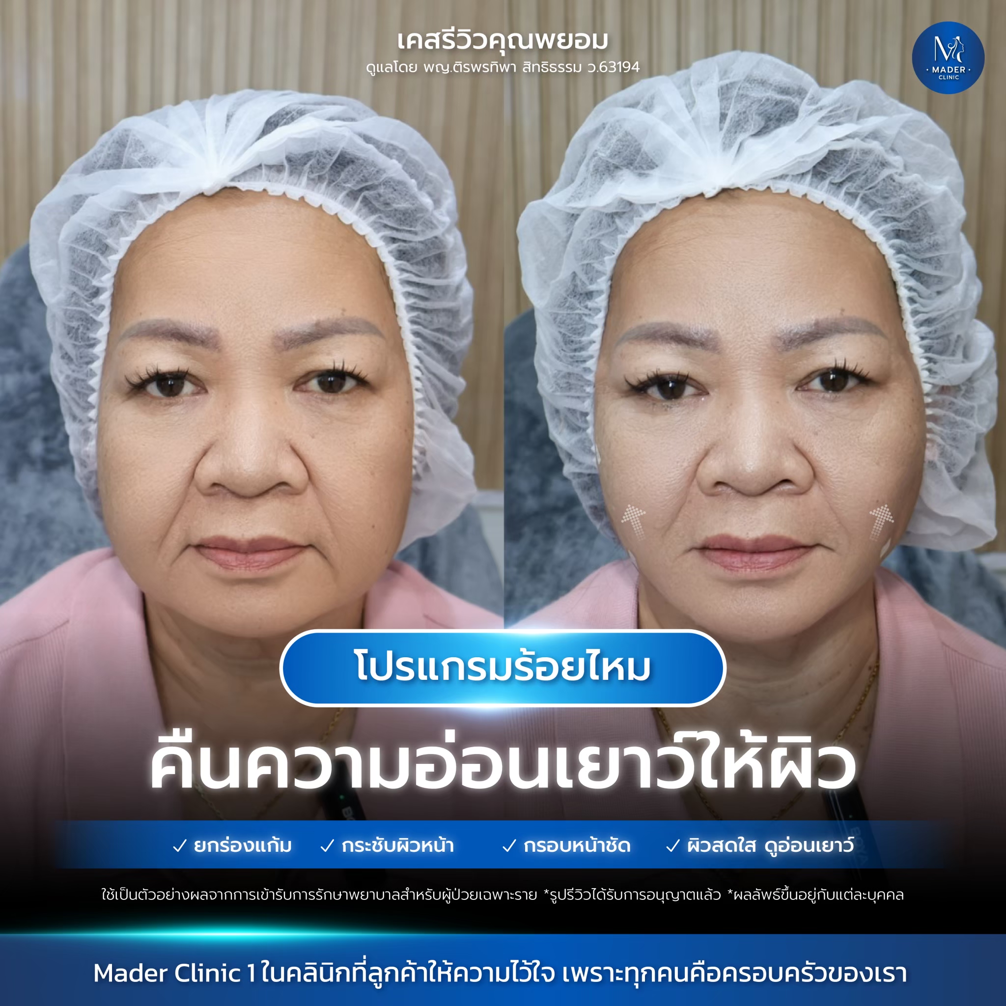 รีวิว MADER Clinic