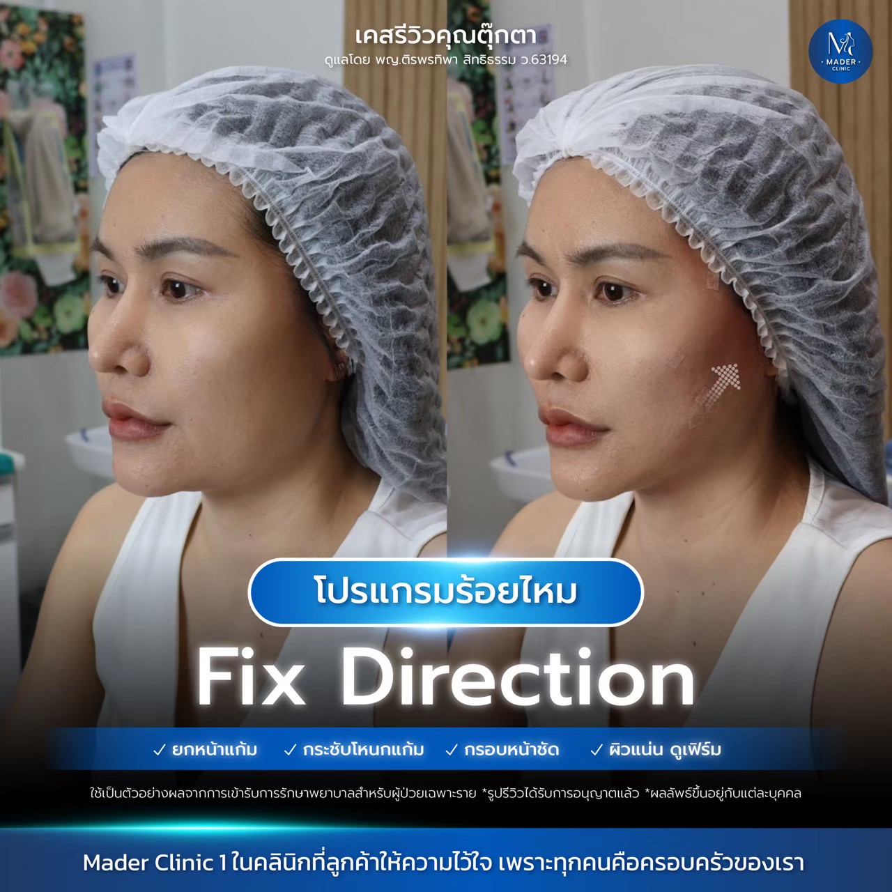 รีวิว MADER Clinic
