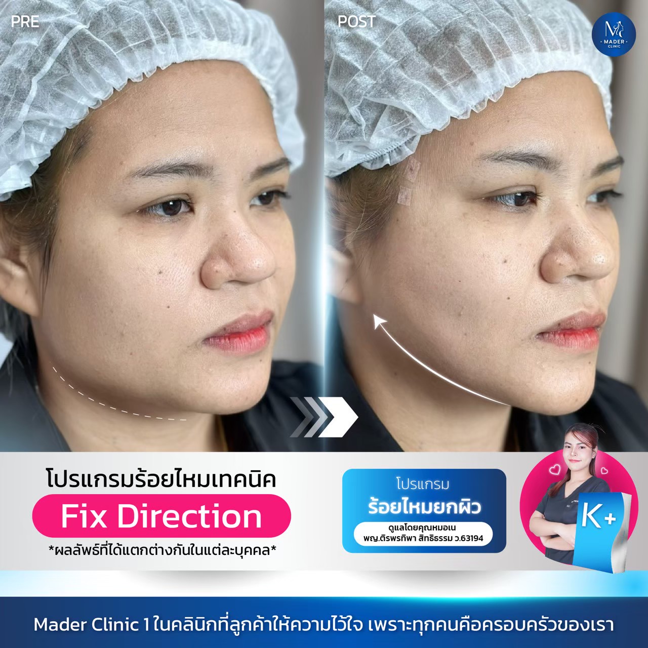 รีวิว MADER Clinic
