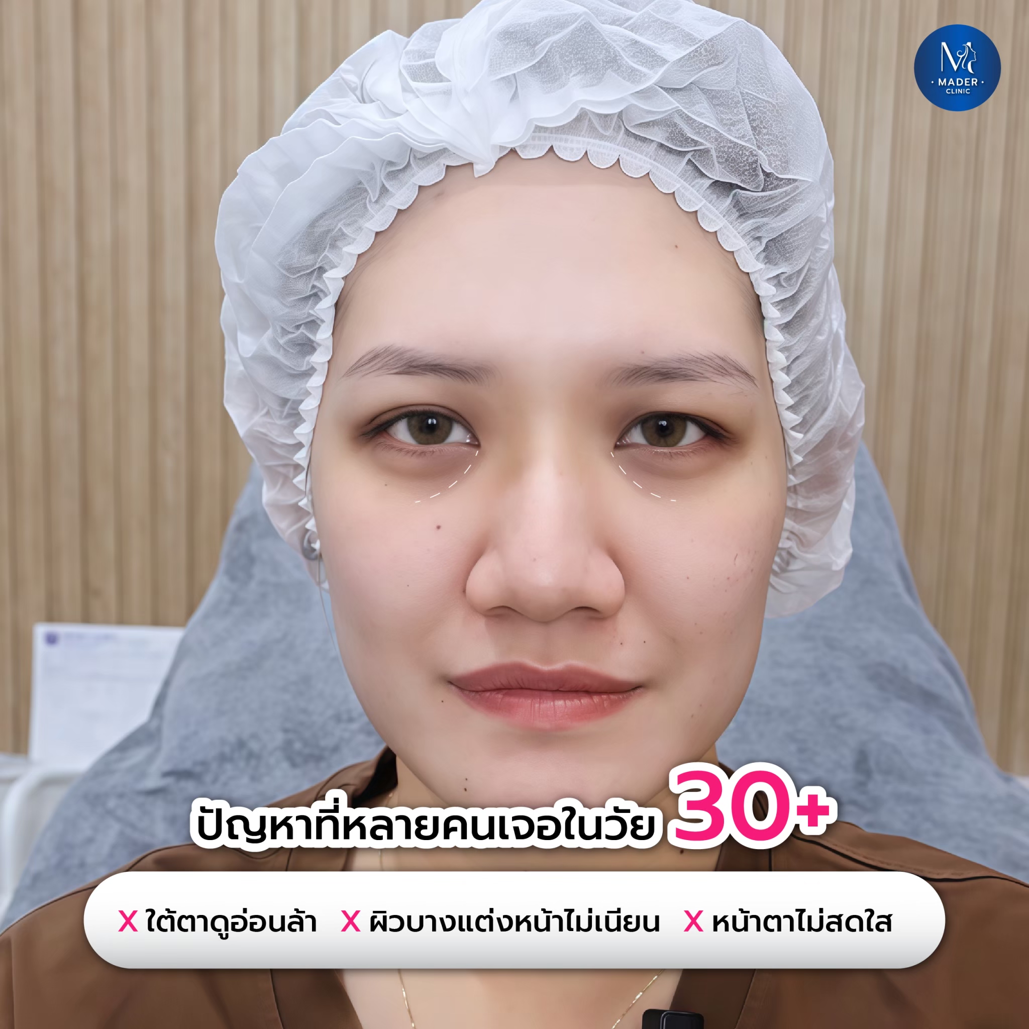 รีวิว MADER Clinic